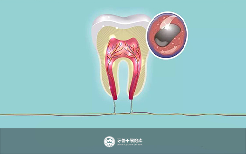 牙齿干细胞